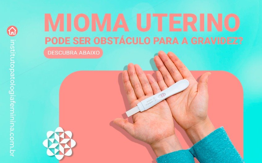 Mioma uterino pode ser obstáculo para a gravidez