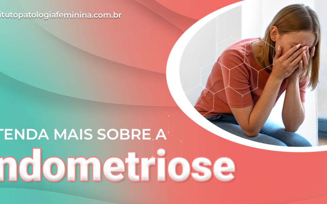 Tudo o que você precisa saber sobre a endometriose