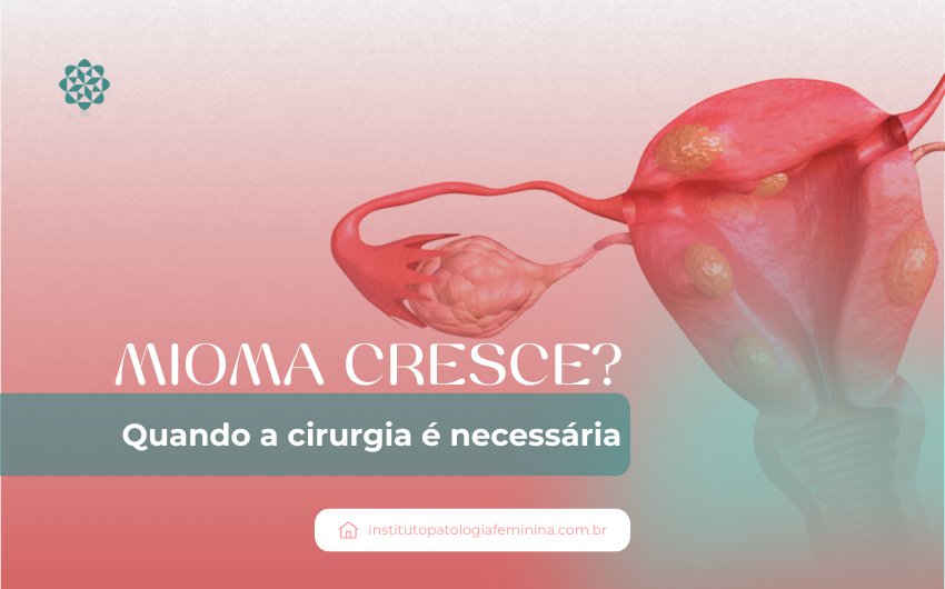 Mioma cresce? Quando a cirurgia é necessária?